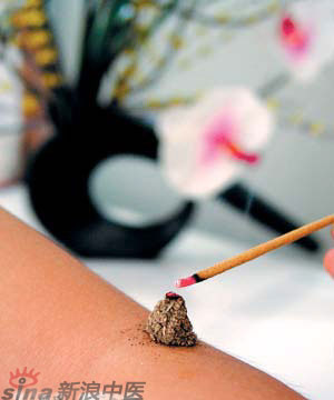 節(jié)氣灸” 冬至，你灸了嗎？