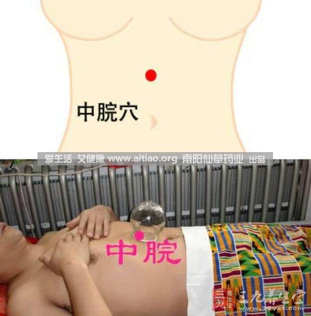 中脘穴位于腹部正中線(xiàn)，臍上4寸的位置上。每天艾灸10-15分鐘，能有效緩解胃部不適的癥狀，同時(shí)有助于祛濕。